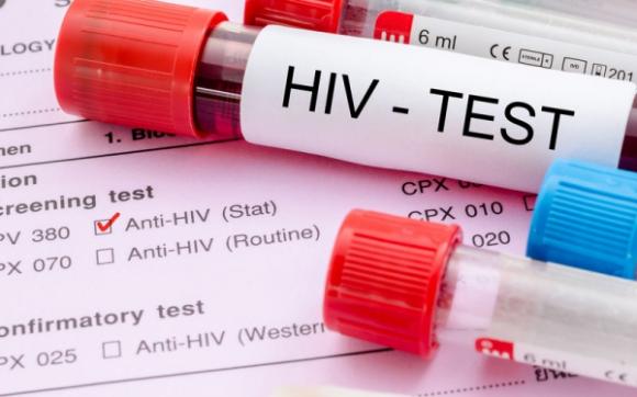 Барнаульцев вновь приглашают пройти бесплатное анонимное тестирование на ВИЧ