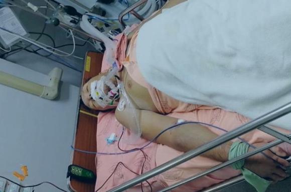 Барнаулец заразился лихорадкой Денге в Тайланде и впал в кому