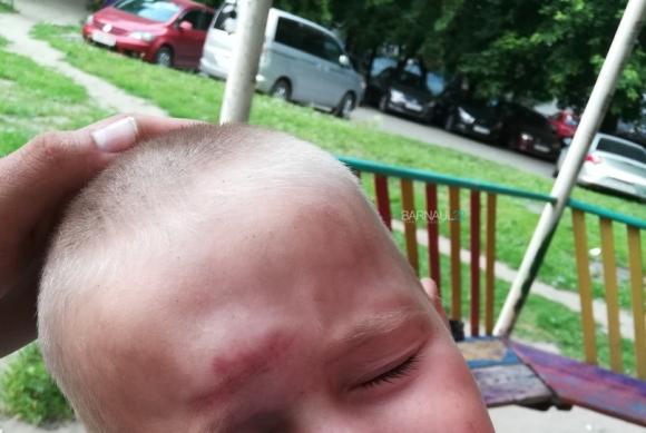 Ребенок ушиб голову на барнаульской детской площадке (фото)