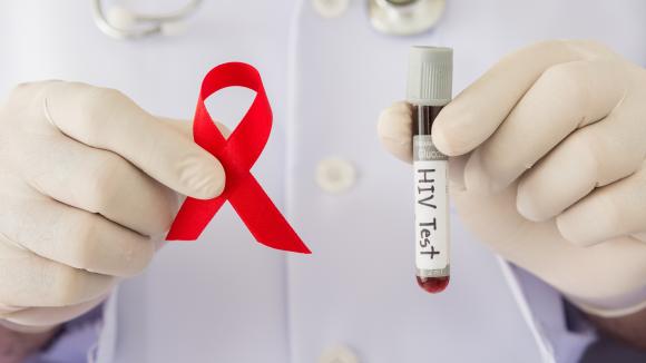 Барнаульцы смогут сдать бесплатный тест на ВИЧ