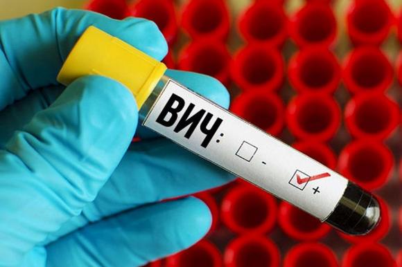 Минздрав предлагает запретить отрицать ВИЧ