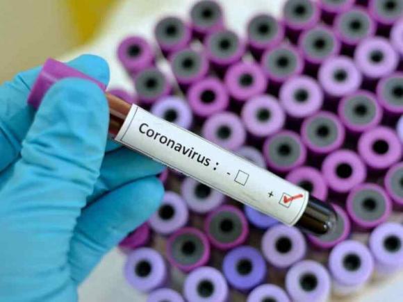 +6. Число заболевших коронавирусом в Алтайском крае выросло до 18