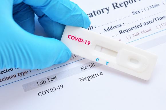 Тест на коронавирус для контактных теперь не обязательный
