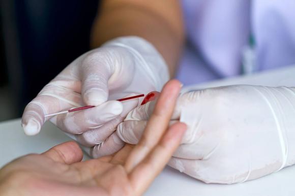 Барнаульцы смогут пройти экспресс-тестирование на ВИЧ в ноябре