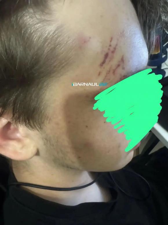 Пинали по голове: в Барнауле подростки напали на сверстника